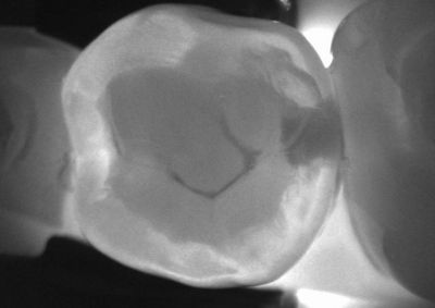 KaVo. Dental Excellence.